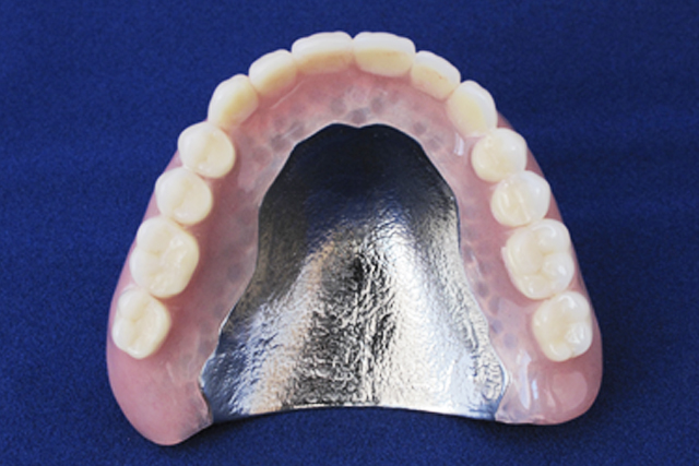 義歯治療 金属床義歯